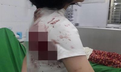 Vụ nữ sinh lớp 11 bị đâm trọng thương: Ban giám hiệu tiết lộ nguyên nhân 
