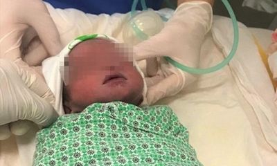 Hà Nội: Bé trai sống sót kỳ diệu khi thai sinh đôi đã sảy trước đó 2 tháng 