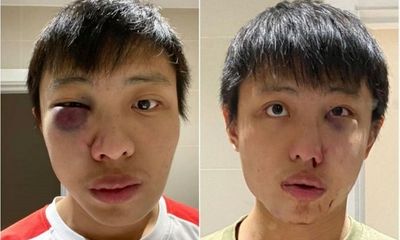 Thiếu niên người Anh hầu tòa vì tấn công du học sinh châu Á 