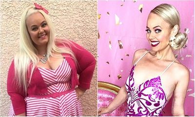  Nàng béo 154kg phẫu thuật cắt bỏ 80% dạ dày, lột xác kinh ngạc để giống búp bê Barbie
