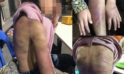 Vụ bé gái 12 tuổi ở Hà Nội nghi bị nhân tình của mẹ xâm hại: Người bố lên tiếng