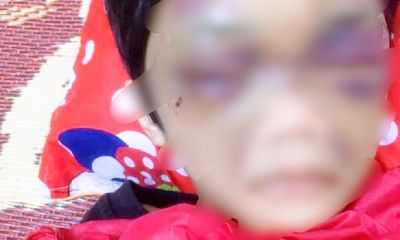 Vụ bé gái 6 tuổi bị mẹ đẻ đánh thâm tím mặt: Hé lộ nguyên nhân