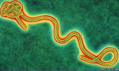 Mỹ xác nhận ca nhiễm virus Ebola đầu tiên ngoài châu Phi