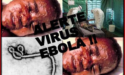 Đại dịch Ebola bắt nguồn từ bé 2 tuổi ở Guinea?
