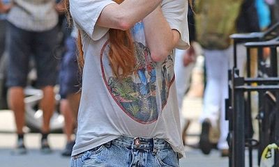 Lindsay Lohan lộ chân thâm tím, nhăn nheo trên phố