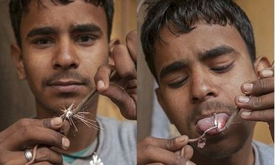 Kỳ lạ cậu bé Ấn Độ chịu được dòng điện 11.000 volt