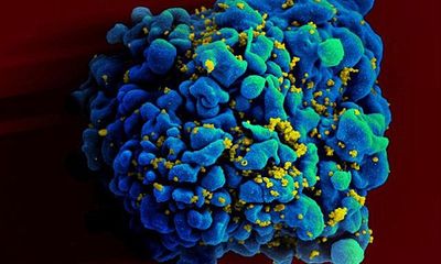 Vắc-xin phòng ngừa virus HIV đã nghiên cứu thành công?