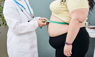WHO xem xét bổ sung thuốc chống béo phì vào danh mục thuốc thiết yếu