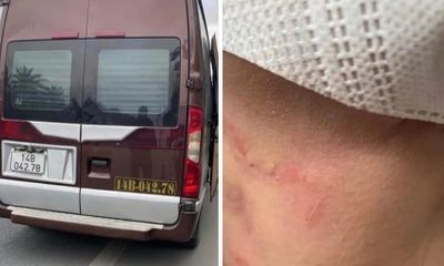 Công an Quảng Ninh điều tra vụ nhà xe bị tố hành hung, bỏ rơi khách giữa cao tốc