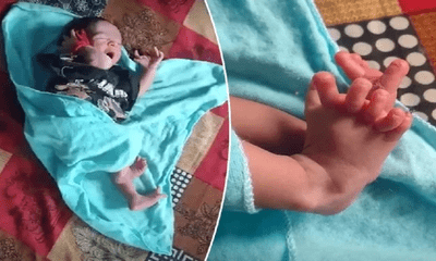 Em bé sở hữu 26 ngón tay, chân, gia đình mừng rỡ vì lý do đặc biệt