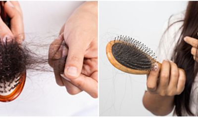 Nếu rụng tóc trên 100 sợi/ngày rất có thể bạn đang gặp vấn đề bất thường do bệnh lý