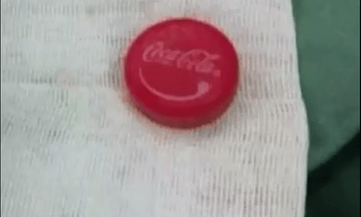 Tin tức đời sống ngày 7/6: Chàng trai suýt vào “cửa tử” vì mở nắp chai Coca bằng miệng