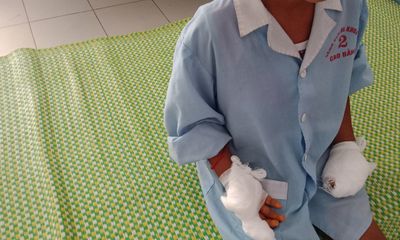 Tin tức đời sống ngày 11/8: Nghịch kíp mìn, bé trai 8 tuổi bị dập nát bàn tay