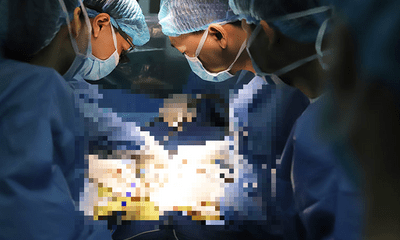 Tin tức đời sống ngày 18/8: Việt Nam lần đầu tiên ghép gan cho em bé bị ung thư gan