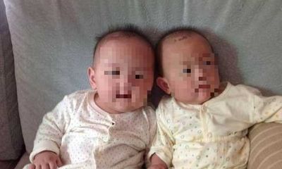 Hai bé trai song sinh trông quá khác nhau, kết quả xét nghiệm ADN vạch trần bí mật cay đắng