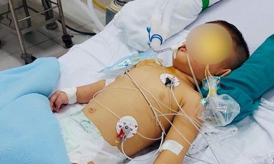 Bé trai 14 tháng tuổi tổn thương não vì gặp tai nạn thương tâm ngay tại nhà