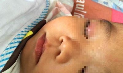 Con trai 4 tuổi nhỏ keo 502 vào mắt, cách sơ cứu của bố được bác sĩ tấm tắc khen ngợi