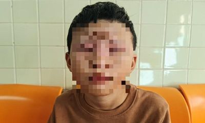 Tin tức đời sống ngày 19/1: Tự chế pháo bằng diêm, bé trai 10 tuổi bị bỏng mặt