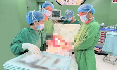 Tin tức đời sống ngày 11/4: Phẫu thuật bóc tách khối u xơ 4,5kg cho bệnh nhân 54 tuổi