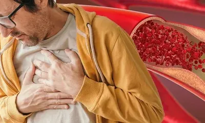 Dấu hiệu cho thấy có cục máu đông trong phổi sau mắc COVID-19