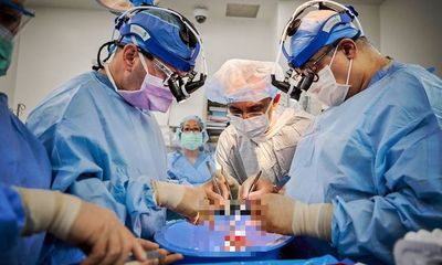 Ghép tim lợn thành công cho hai bệnh nhân chết não