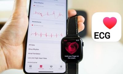 Công nghệ - Tin tức công nghệ mới nóng nhất hôm nay 24/7: Apple Watch giúp người phụ nữ phát hiện khối u