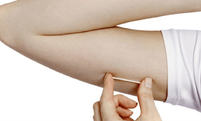 Tin tức đời sống ngày 30/9: Que tránh thai đi lạc vào sâu trong cơ bắp tay người phụ nữ