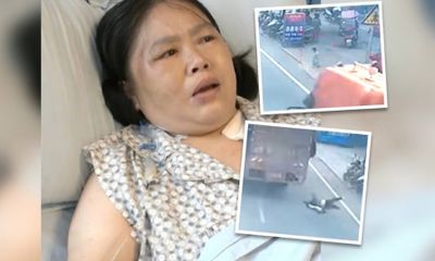 Người phụ nữ mất cánh tay trái khi lao ra trước đầu xe tải cứu đứa trẻ 2 tuổi 