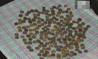 Cộng đồng mạng - Bác sĩ sửng sốt phát hiện 187 đồng tiền xu trong bụng người đàn ông