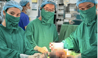 Hi hữu sản phụ 28 tuổi ở Hà Nội sinh đôi, một bé vẫn còn nguyên trong bọc ối