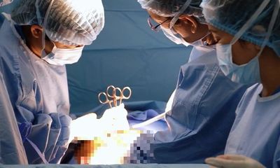 Tin tức đời sống ngày 20/3: Bác sĩ choáng khi lấy khối u nặng 11kg khỏi bụng người phụ nữ