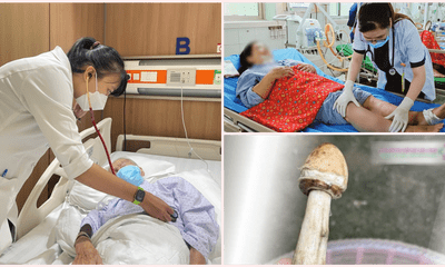 Tin tức đời sống mới nhất ngày 31/8: Người phụ nữ hoại tử tay chân do tự tiêm canxi 