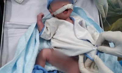 TP.HCM: Bé trai chào đời trong phòng hồi sức điều trị bệnh nhân mắc COVID-19