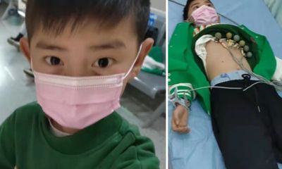 Xúc động con trai 10 tuổi nín đau rút 30 ống máu làm xét nghiệm hiến tủy cứu mẹ