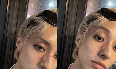 Nam ca sĩ Hàn Quốc bị tấn công trên phố vì là người đồng tính