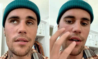 Justin Bieber bị liệt cơ mặt vì hội chứng hiếm gặp