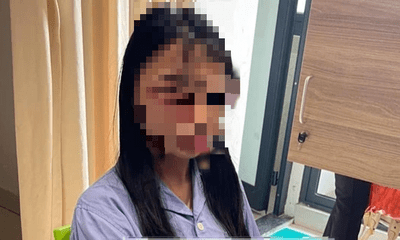Công an giám định thương tích nữ sinh lớp 8 ở Hà Nội bị đánh hội đồng