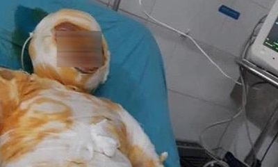 Vụ nghi án chồng tẩm xăng đốt vợ ở Đồng Nai: Hé lộ nguyên nhân