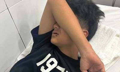 Điều tra vụ đi tắm biển, thiếu niên 14 tuổi ở Đà Nẵng bị người lạ đánh gãy 4 răng