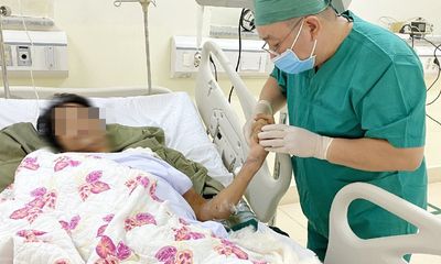 Nối thành công bàn tay bị trộm chém cho bệnh nhân 