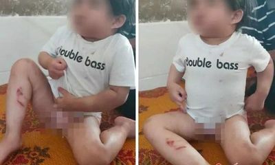 Vụ dì ruột đánh cháu 4 tuổi bầm tím khắp người ở Hà Tĩnh: Trưởng Công an huyện nói gì?