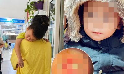 Bệnh viện Mắt Hà Nội lên tiếng vụ bé trai 2 tuổi mù lòa một bên mắt sau khi bóc giả mạc