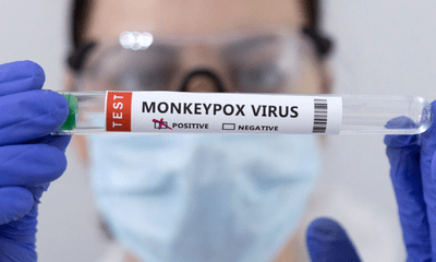 New York đề nghị WHO đổi tên bệnh đậu mùa khỉ để tránh 'kỳ thị'