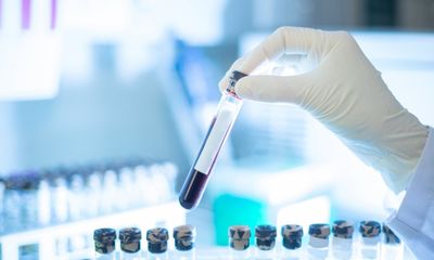 Cần biết - Xét nghiệm máu phát hiện sớm đa ung thư của công ty Grail trên lộ trình xin được FDA cấp phép 