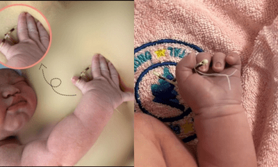 Sự thật đằng sau hình ảnh em bé chào đời cầm trên tay chiếc vòng tránh thai