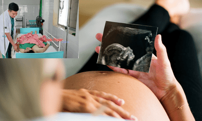 Cứu sống nữ bệnh nhân vỡ thai ngoài tử cung