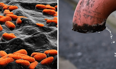Sử dụng nguồn nước nhiễm vi khuẩn E.Coli, nguy cơ đối mặt với bệnh nguy hiểm