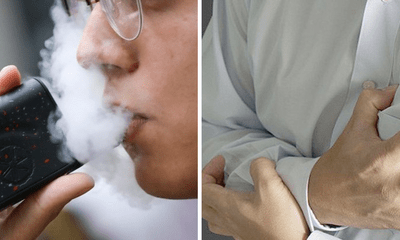 Liên tiếp 2 thanh niên tổn thương phổi vì thuốc lá điện tử, bác sĩ ra cảnh báo