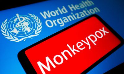 Các triệu chứng mới nhất và yếu tố nguy cơ của bệnh đậu mùa ở khỉ 