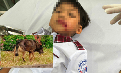 Vụ chó lạ tấn công học sinh ở Đắk Nông: Con chó dương tính với vi rút dại